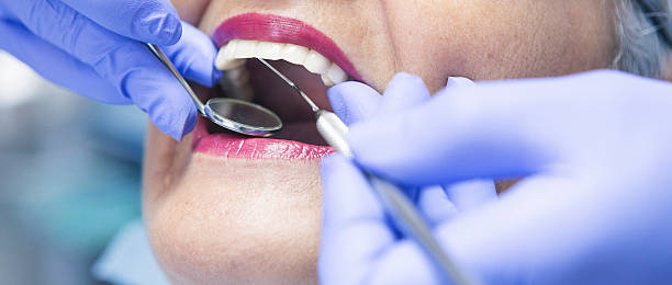 Best Emergency Dentist for Lost Fillings or Crowns in Fort Gibson, OK